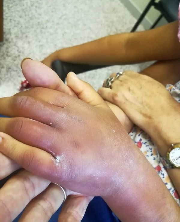 Prisión para guardadora por lesión grave sufrida por niña - Judiciales y Policiales - ABC Color