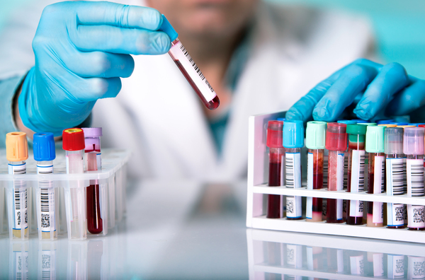Salud habilitará más laboratorios para superar las 1.000 pruebas diarias de COVID-19