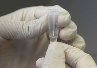 COVID-19: “test rápidos” laboratoriales arrojarán resultados en menos de 24 horas, indica ministro de la ARRN  - Ancho Perfil - ABC Color
