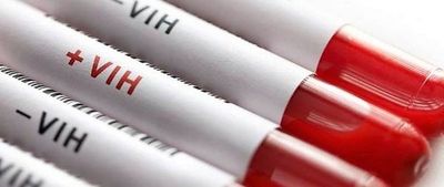 VIH: pacientes no deben abandonar tratamiento, dice Salud