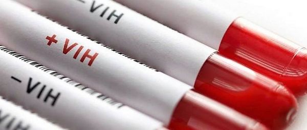 VIH: pacientes no deben abandonar tratamiento, dice Salud