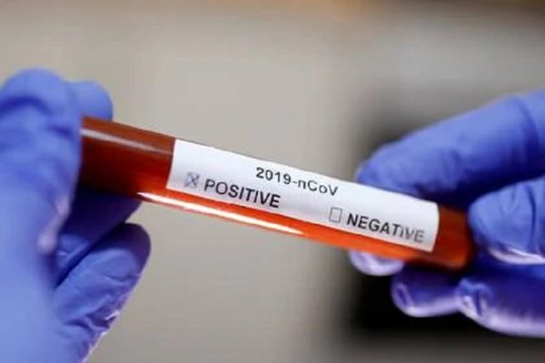 Fiscalía exige que seccionaleros se sometan a test de Covid19 | Noticias Paraguay