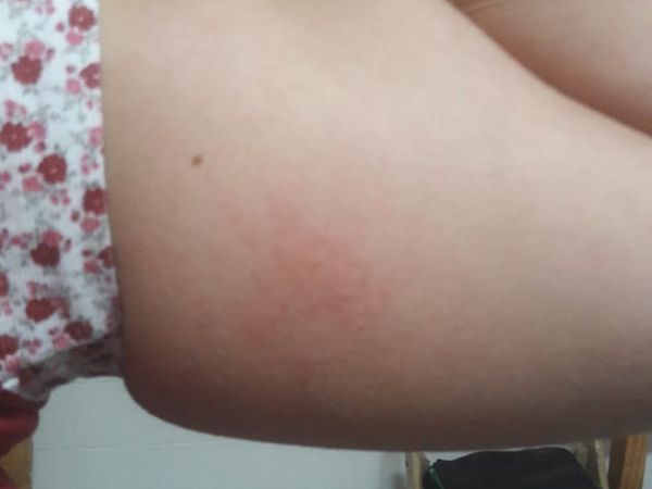 Comisario supuestamente agredió a obstetra por pedirle que cumpla con protocolo sanitario