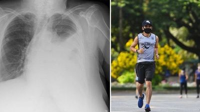 Correr con tapabocas puede afectar el pulmón y llevar a un colapso