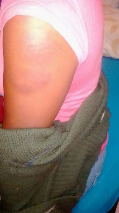 Mujer fue brutalmente golpeada en Calle 4 - Campo 9 Noticias