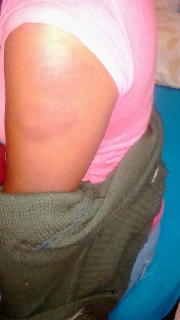 Mujer fue brutalmente golpeada en Calle 4 - Campo 9 Noticias