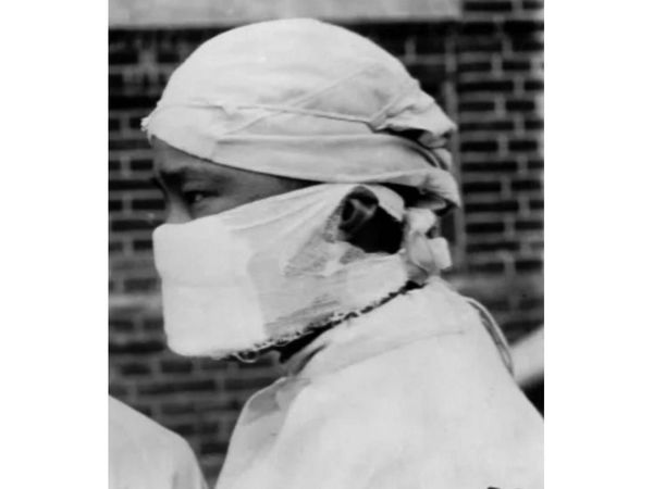 La mascarilla y una evolución marcada por pestes e infecciones