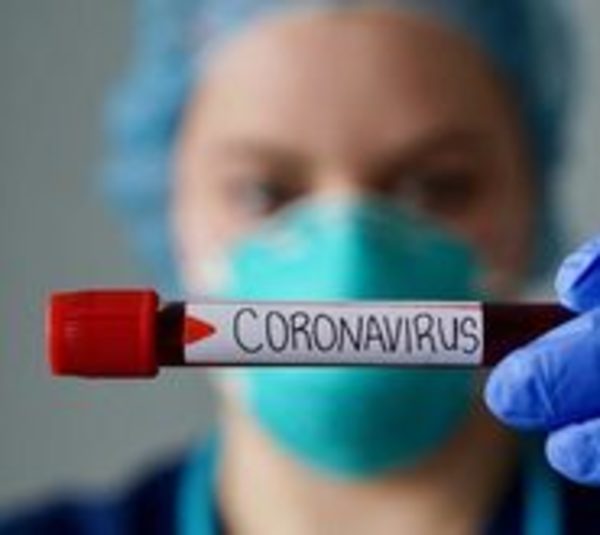 Salud reporta 8 nuevos casos de Covid-19 - Paraguay.com