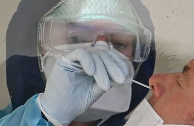 Los anticuerpos de un paciente recuperado del SARS inhiben el SARS-CoV-2 - Ciencia - ABC Color