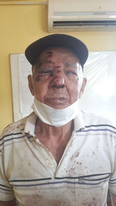 Hombre agrede con brutalidad a su tío septuagenario por negarse a mirar una imagen en el celular - Nacionales - ABC Color