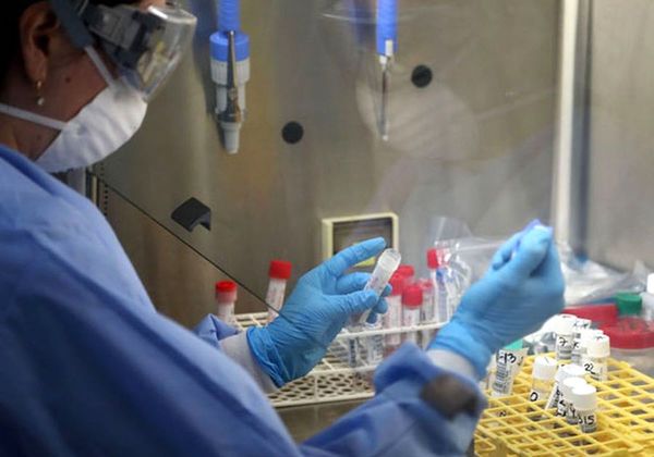 Anticuerpos monoclonales: ¿Arma contra el coronavirus?