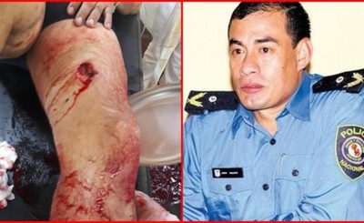 Comisario apuñalado tras reducir a un hombre armado en O´leary