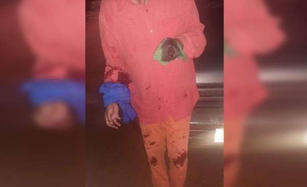 Queman un biciclo y cortan la mano a su dueño con un machetillo