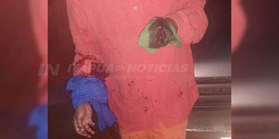 DE UN MACHETAZO LE AMPUTARON LA MANO