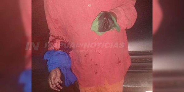 DE UN MACHETAZO LE AMPUTARON LA MANO