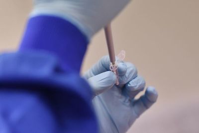 Primeras pruebas de vacuna china contra COVID dan resultados positivos - Mundo - ABC Color