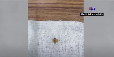 ¡Atención padres! Niño se atraganta con espina de una planta | Noticias Paraguay