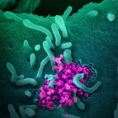 Continúa desarrollo de anticuerpos contra el COVID-19 – Prensa 5