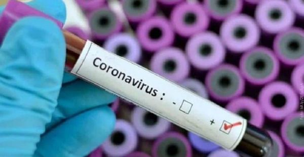 Cinco personas albergadas en Coronel Oviedo dan positivo a Covid-19 – Prensa 5