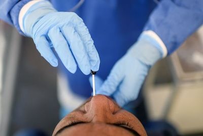Más de 344.000 muertos en el mundo por coronavirus - Mundo - ABC Color