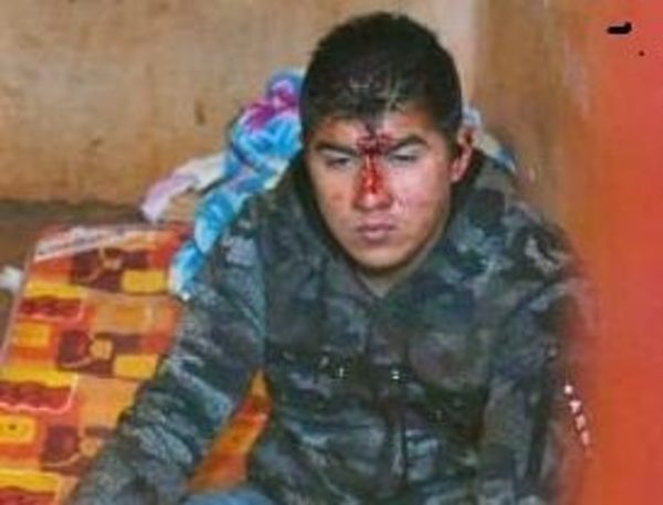 Imputan a dos asaltantes por  robo con resultado de lesión grave – Diario TNPRESS