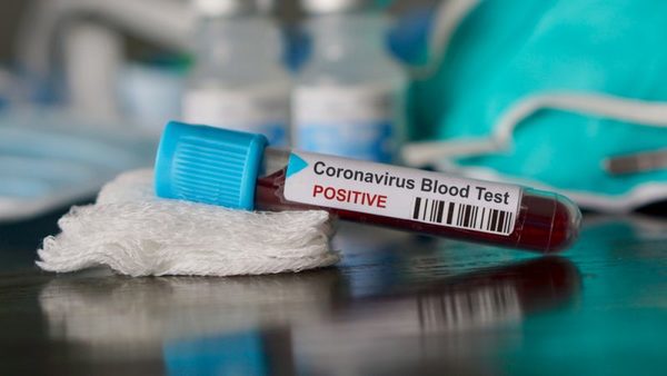 Volvieron los sin nexo: Salud reporta 16 nuevos casos positivos de coronavirus