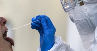 Detectan tres casos con altísima carga viral
