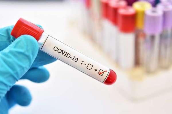 8 casos sin nexo en dos días: Salud reporta 17 casos nuevos de coronavirus