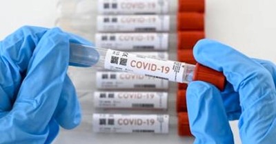 Suman 995 casos de covid-19 en el país