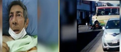 Motociclista arrollado: "El bus quedó sobre mi espalda" | Noticias Paraguay
