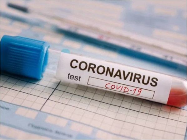 Los primeros tres clubes que se harán los test de coronavirus