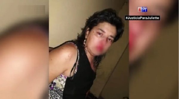 Mujer teme por su vida ya que su presunto agresor recuperaría su libertad | Noticias Paraguay
