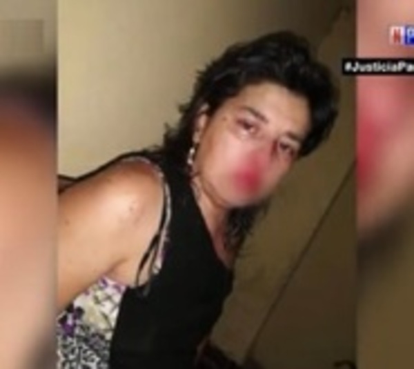 Mujer teme por su vida ya que su presunto agresor quedaría libre - Paraguay.com