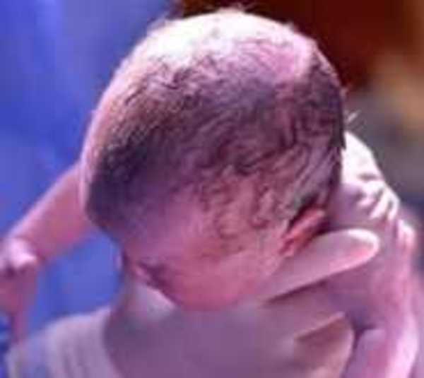 Nace bebé sana de paciente con coronavirus  - Paraguay.com