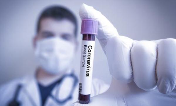Se espera para setiembre vacuna de Oxford contra el COVID-19 – Prensa 5