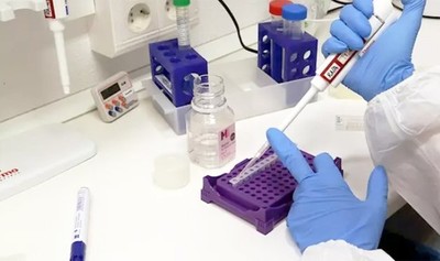 Diez personas de la XIII Región Sanitaria van a cuarentena, tras confirmarse que una funcionaria dio positivo al COVID » Ñanduti