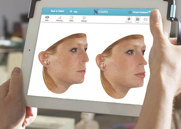 Implementan inteligencia artificial para reconstruir cuerpo poscirugía de pacientes