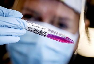 Empresas japonesas inventan tejido eléctrico para destruir microbios, virus y bacterias - Tecnología - ABC Color