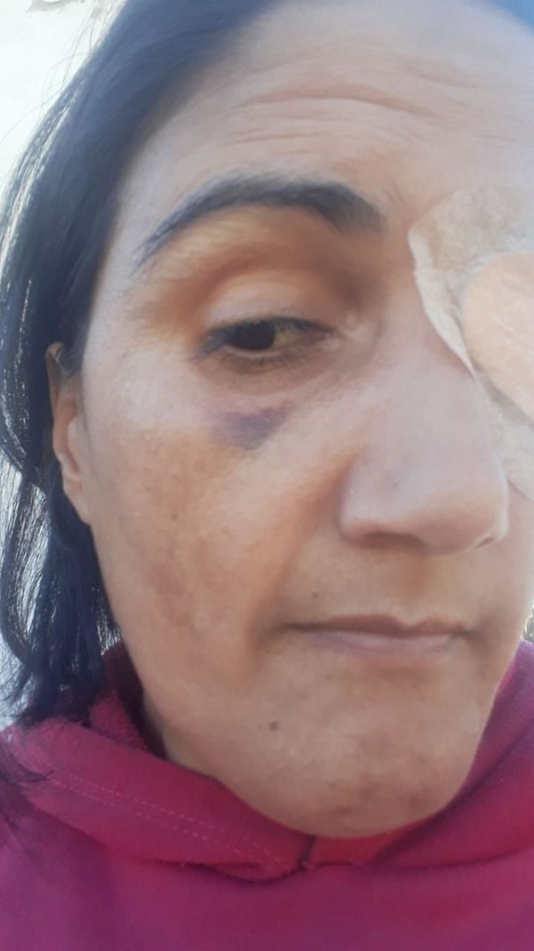 Una mujer con ceguera denuncia agresión y discriminación en juzgado de J. Augusto Saldivar. - Nacionales - ABC Color