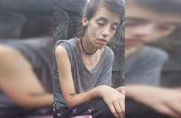 El impactante 'antes y después' de una joven adicta a las drogas - C9N