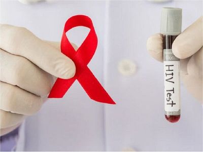 Descubren el primer caso de VIH resistente a antirretrovirales