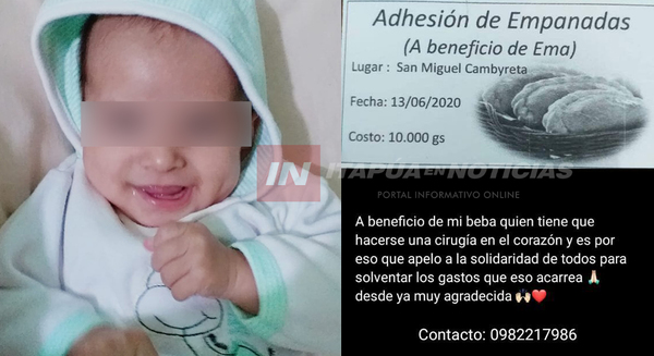 TODOS POR EMMA: LA BEBÉ DE 5 MESES DEBE PASAR POR UNA CIRUGÍA DEL CORAZÓN.