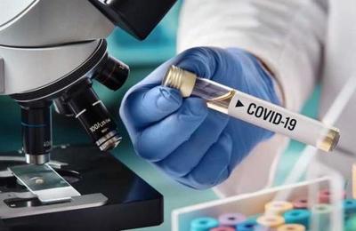 Investigación de Harvard señala que el coronavirus pudo estar en Wuhan desde agosto - C9N