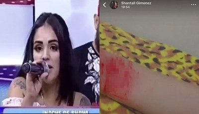 "Ex Culisuelta" fue rescatada tras intento de suicidio - Teleshow