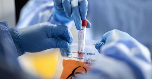 Con 15 nuevos casos de covid-19 suman 1.202 en el país