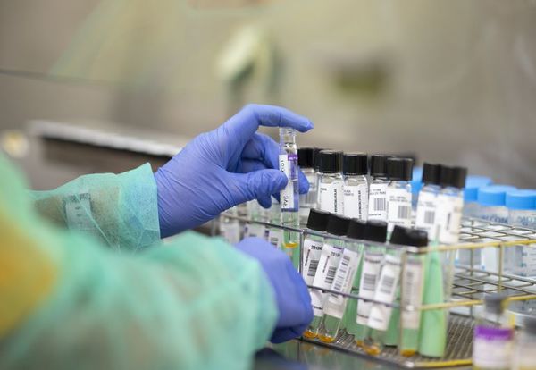 Reto de vacuna contra COVID-19 será producción masiva - Mundo - ABC Color