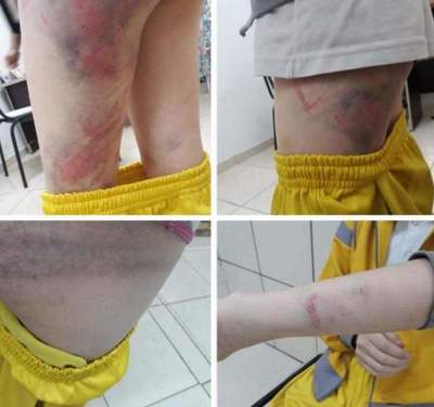 Brutal golpiza a criatura en Ciudad del Este - Campo 9 Noticias