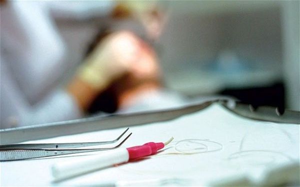 Instan a tener cuidado con atención odontológica no profesional  - Nacionales - ABC Color