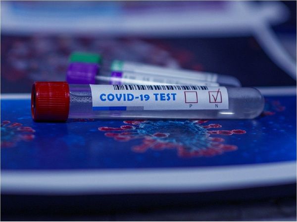 Hombre de 53 años, víctima del Covid y casos suman 12