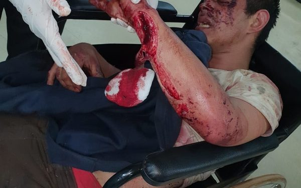 Procesan a tres personas por hurto agravado y transgresión de la cuarentena sanitaria – Diario TNPRESS